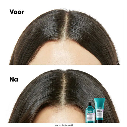 https://cdn.shopify.com/s/files/1/0915/0932/6199/files/loreal-professionnel-loreal-scalp-advanced-anti-discomfort-shampoo-r.464864493.webp?v=1755912264
