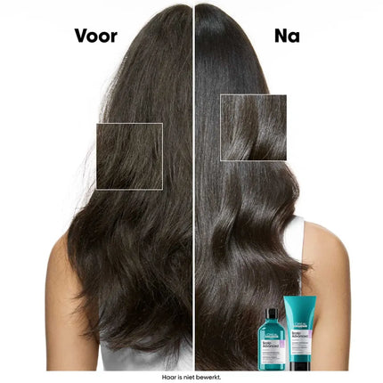 https://cdn.shopify.com/s/files/1/0915/0932/6199/files/loreal-professionnel-loreal-scalp-advanced-anti-discomfort-shampoo-r.464864494.webp?v=1755912264